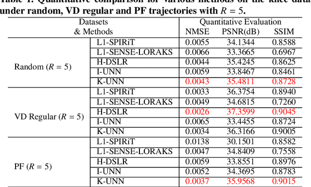 Figure 2 for K-UNN: k-Space Interpolation With Untrained Neural Network