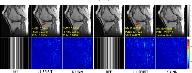 Figure 4 for K-UNN: k-Space Interpolation With Untrained Neural Network