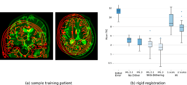 Figure 4 for Deep Information Theoretic Registration