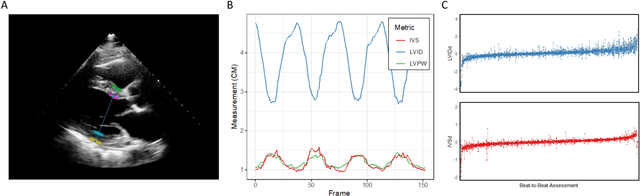 Figure 2 for High-Throughput Precision Phenotyping of Left Ventricular Hypertrophy with Cardiovascular Deep Learning