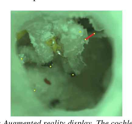 Figure 1 for 3D landmark detection for augmented reality based otologic procedures