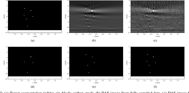 Figure 3 for Fast ultrasonic imaging using end-to-end deep learning