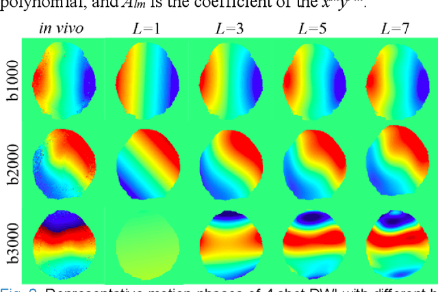 Figure 1 for Physics-informed deep diffusion MRI reconstruction: break the bottleneck of training data in artificial intelligence