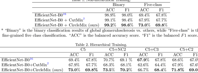 Figure 3 for Improve Global Glomerulosclerosis Classification with Imbalanced Data using CircleMix Augmentation