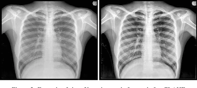 Figure 4 for Attention U-Net Based Adversarial Architectures for Chest X-ray Lung Segmentation