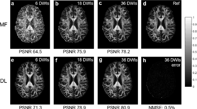Figure 2 for Deep Learning for Highly Accelerated Diffusion Tensor Imaging