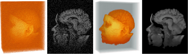 Figure 4 for Anisotropic Diffusion in ITK