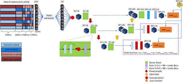 Figure 1 for Fast Dynamic Perfusion and Angiography Reconstruction using an end-to-end 3D Convolutional Neural Network