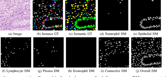 Figure 1 for ciscNet -- A Single-Branch Cell Instance Segmentation and Classification Network