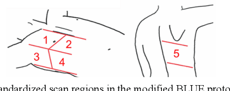 Figure 1 for Tele-operative Robotic Lung Ultrasound Scanning Platform for Triage of COVID-19 Patients