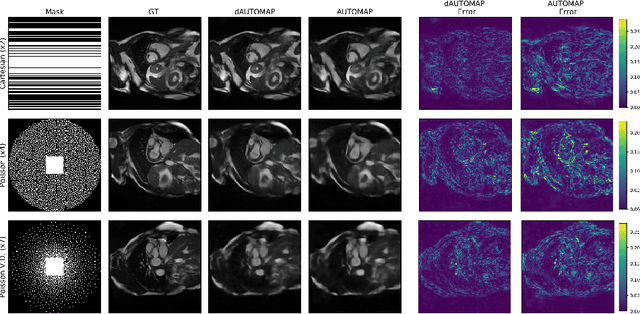 Figure 3 for dAUTOMAP: decomposing AUTOMAP to achieve scalability and enhance performance
