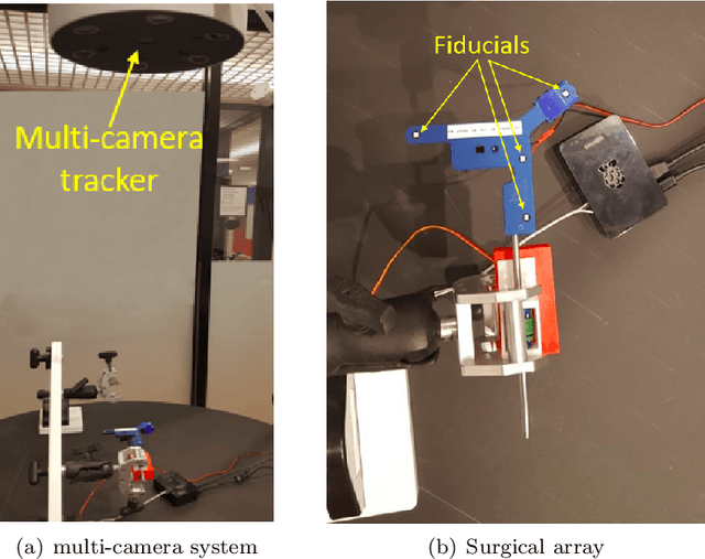 Figure 1 for Fast and Robust Localization of Surgical Array using Kalman Filter