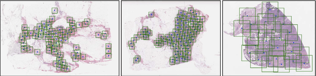 Figure 3 for A Unified Framework for Tumor Proliferation Score Prediction in Breast Histopathology