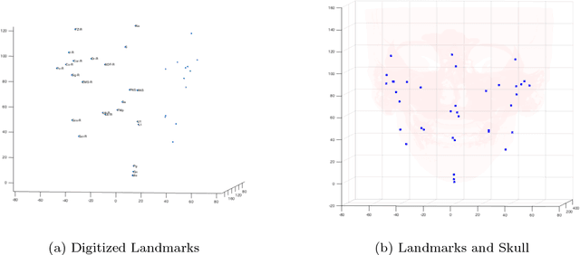 Figure 3 for Calculating the Midsagittal Plane for Symmetrical Bilateral Shapes: Applications to Clinical Facial Surgical Planning