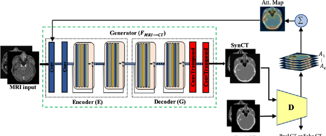Figure 1 for Attention-Guided Generative Adversarial Network to Address Atypical Anatomy in Modality Transfer