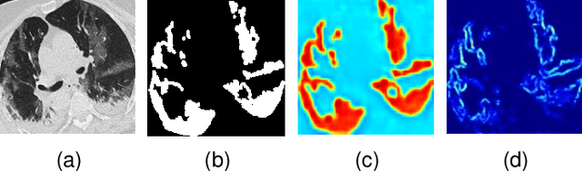 Figure 4 for BCS-Net: Boundary, Context and Semantic for Automatic COVID-19 Lung Infection Segmentation from CT Images