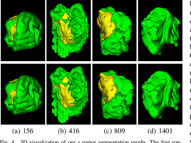 Figure 4 for CKD-TransBTS: Clinical Knowledge-Driven Hybrid Transformer with Modality-Correlated Cross-Attention for Brain Tumor Segmentation