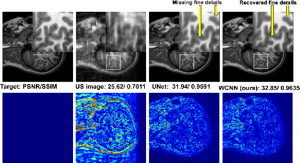 Figure 1 for DC-WCNN: A deep cascade of wavelet based convolutional neural networks for MR Image Reconstruction