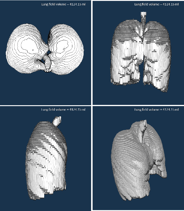 Figure 4 for CIDI-Lung-Seg: A Single-Click Annotation Tool for Automatic Delineation of Lungs from CT Scans