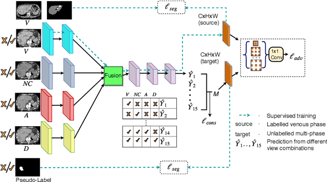 Figure 3 for Co-Heterogeneous and Adaptive Segmentation from Multi-Source and Multi-Phase CT Imaging Data: A Study on Pathological Liver and Lesion Segmentation