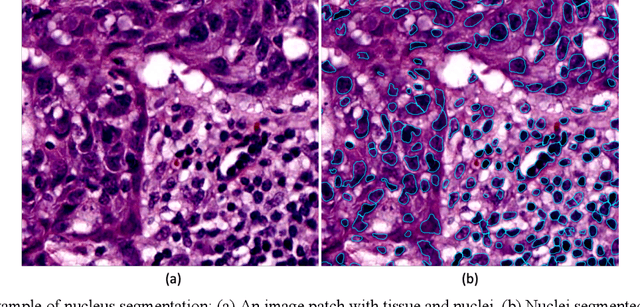 Figure 3 for AI and Pathology: Steering Treatment and Predicting Outcomes