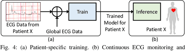 Figure 4 for LSTM-Based ECG Classification for Continuous Monitoring on Personal Wearable Devices