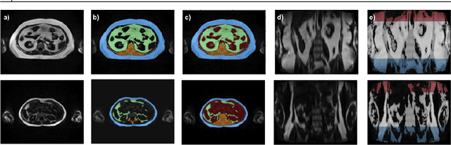 Figure 1 for FatSegNet : A Fully Automated Deep Learning Pipeline for Adipose Tissue Segmentation on Abdominal Dixon MRI