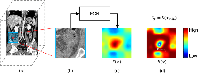 Figure 1 for Reinforcement Learning-based Automatic Diagnosis of Acute Appendicitis in Abdominal CT
