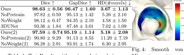 Figure 4 for Auto-segmentation of Hip Joints using MultiPlanar UNet with Transfer learning