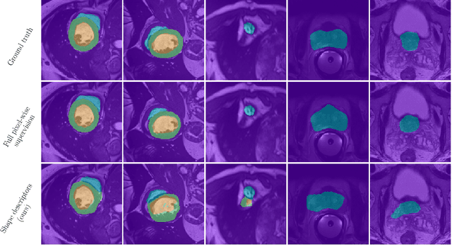 Figure 3 for Beyond pixel-wise supervision for segmentation: A few global shape descriptors might be surprisingly good!