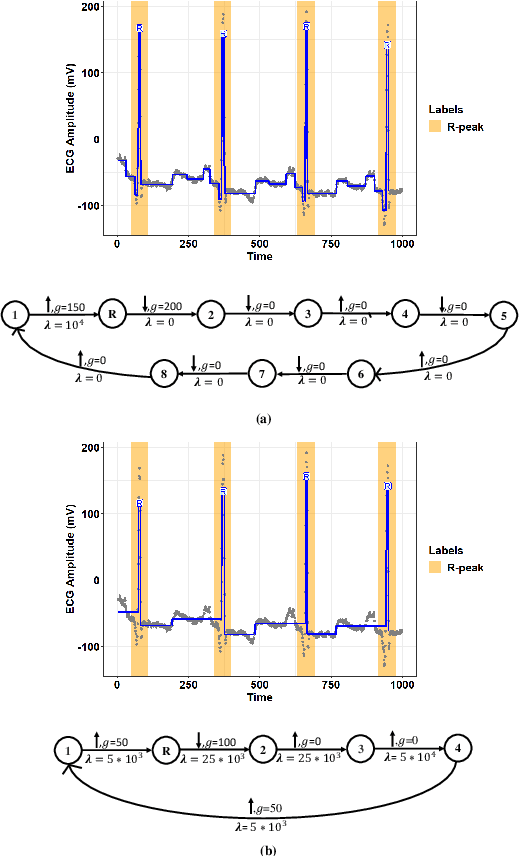 Figure 2 for A Greedy Graph Search Algorithm Based on Changepoint Analysis for Automatic QRS Complex Detection