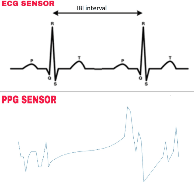 Figure 1 for Long Short-Term Network Based Unobtrusive Perceived Workload Monitoring with Consumer Grade Smartwatches in the Wild