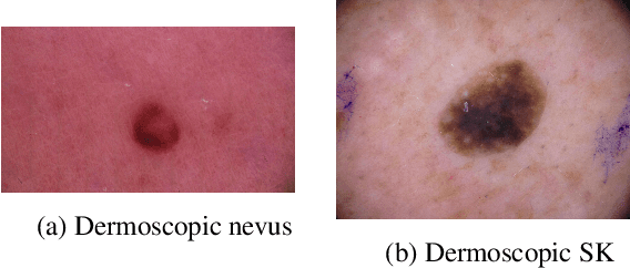 Figure 1 for Out-of-Distribution Detection for Dermoscopic Image Classification