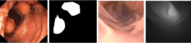 Figure 1 for Task-Aware Active Learning for Endoscopic Image Analysis