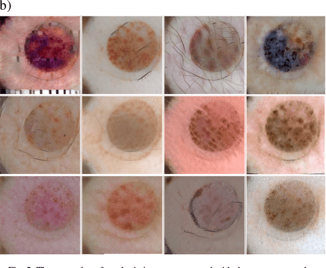 Figure 3 for Style transfer-based image synthesis as an efficient regularization technique in deep learning