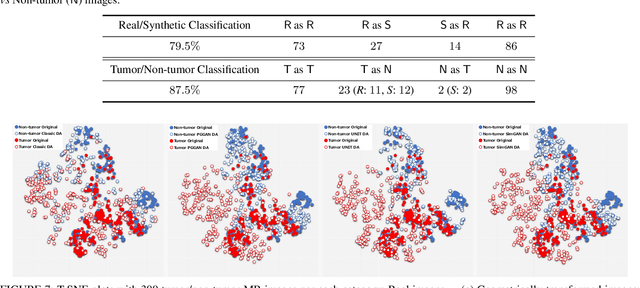 Figure 4 for Combining Noise-to-Image and Image-to-Image GANs: Brain MR Image Augmentation for Tumor Detection