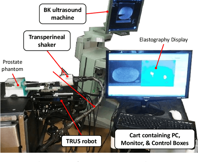 Figure 1 for Quasi-Real Time Multi-Frequency 3D Shear Wave Absolute Vibro-Elastography System for Prostate