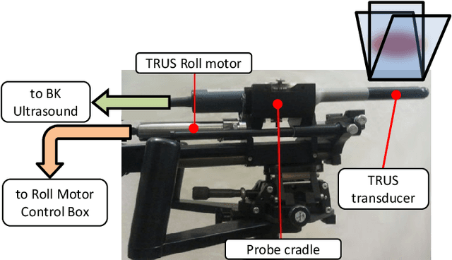 Figure 2 for Quasi-Real Time Multi-Frequency 3D Shear Wave Absolute Vibro-Elastography System for Prostate