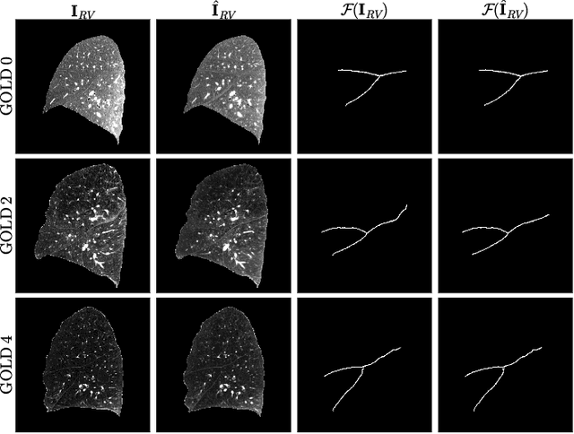 Figure 2 for Lung2Lung: Volumetric Style Transfer with Self-Ensembling for High-Resolution Cross-Volume Computed Tomography