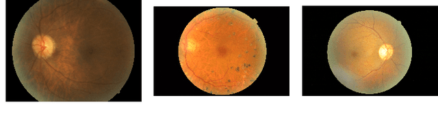 Figure 1 for Renyi Fair Information Bottleneck for Image Classification