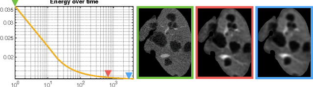 Figure 3 for Automated Unsupervised Segmentation of Liver Lesions in CT scans via Cahn-Hilliard Phase Separation