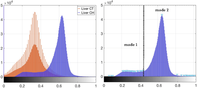 Figure 4 for Automated Unsupervised Segmentation of Liver Lesions in CT scans via Cahn-Hilliard Phase Separation