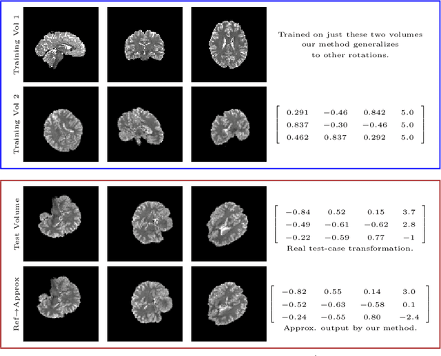 Figure 3 for Equivariant Filters for Efficient Tracking in 3D Imaging
