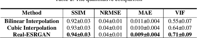Figure 3 for Single MR Image Super-Resolution using Generative Adversarial Network