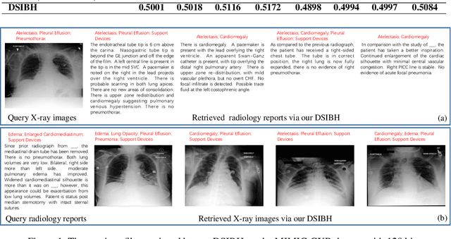 Figure 2 for Deep Supervised Information Bottleneck Hashing for Cross-modal Retrieval based Computer-aided Diagnosis
