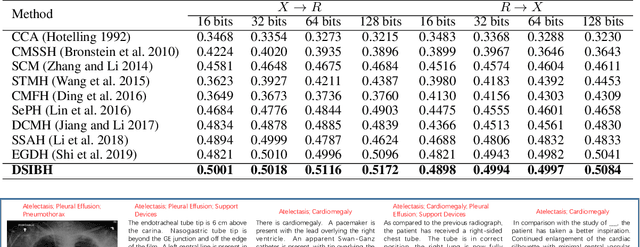 Figure 1 for Deep Supervised Information Bottleneck Hashing for Cross-modal Retrieval based Computer-aided Diagnosis