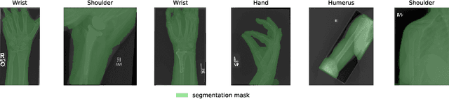 Figure 3 for Anomaly Detection on X-Rays Using Self-Supervised Aggregation Learning