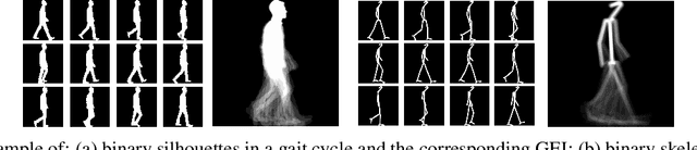 Figure 4 for Remote Pathological Gait Classification System