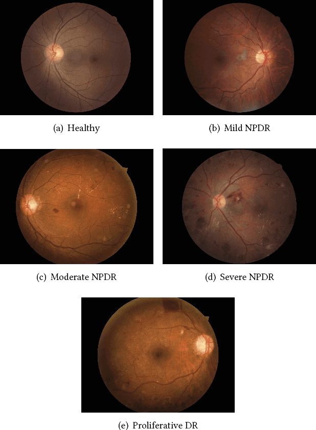 Figure 3 for Who Said What: Modeling Individual Labelers Improves Classification
