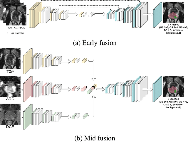 Figure 3 for Perfusion imaging in deep prostate cancer detection from mp-MRI: can we take advantage of it?